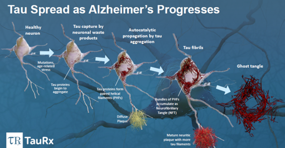 Tau Spread as Alzheimer's Progresses